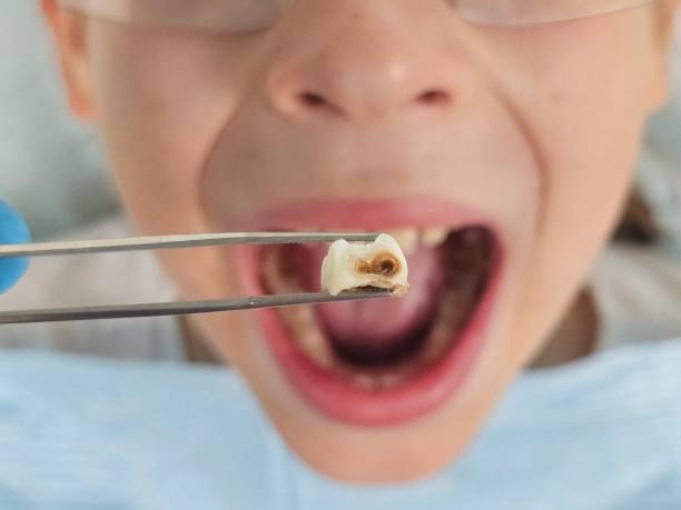 Best Cracked Tooth Emergency Dentist  in Gibbsboro, NJ